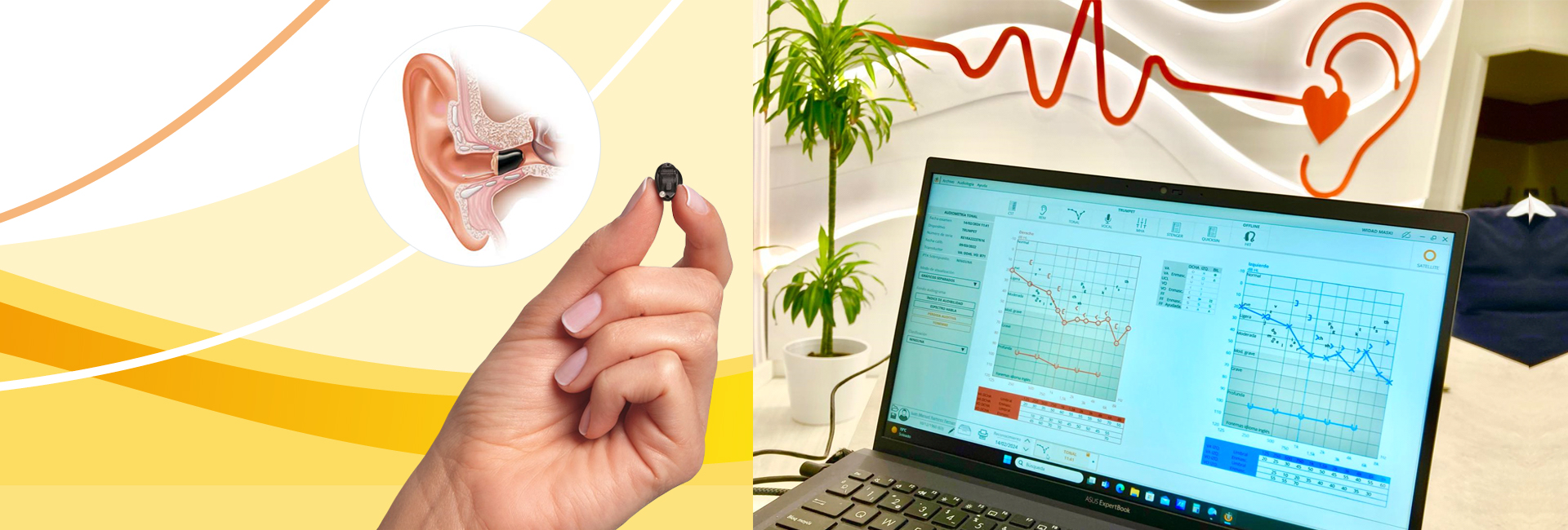 Audiología Ciudad Real